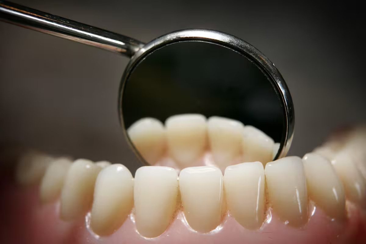 20-facts-on-dental-health-teeth