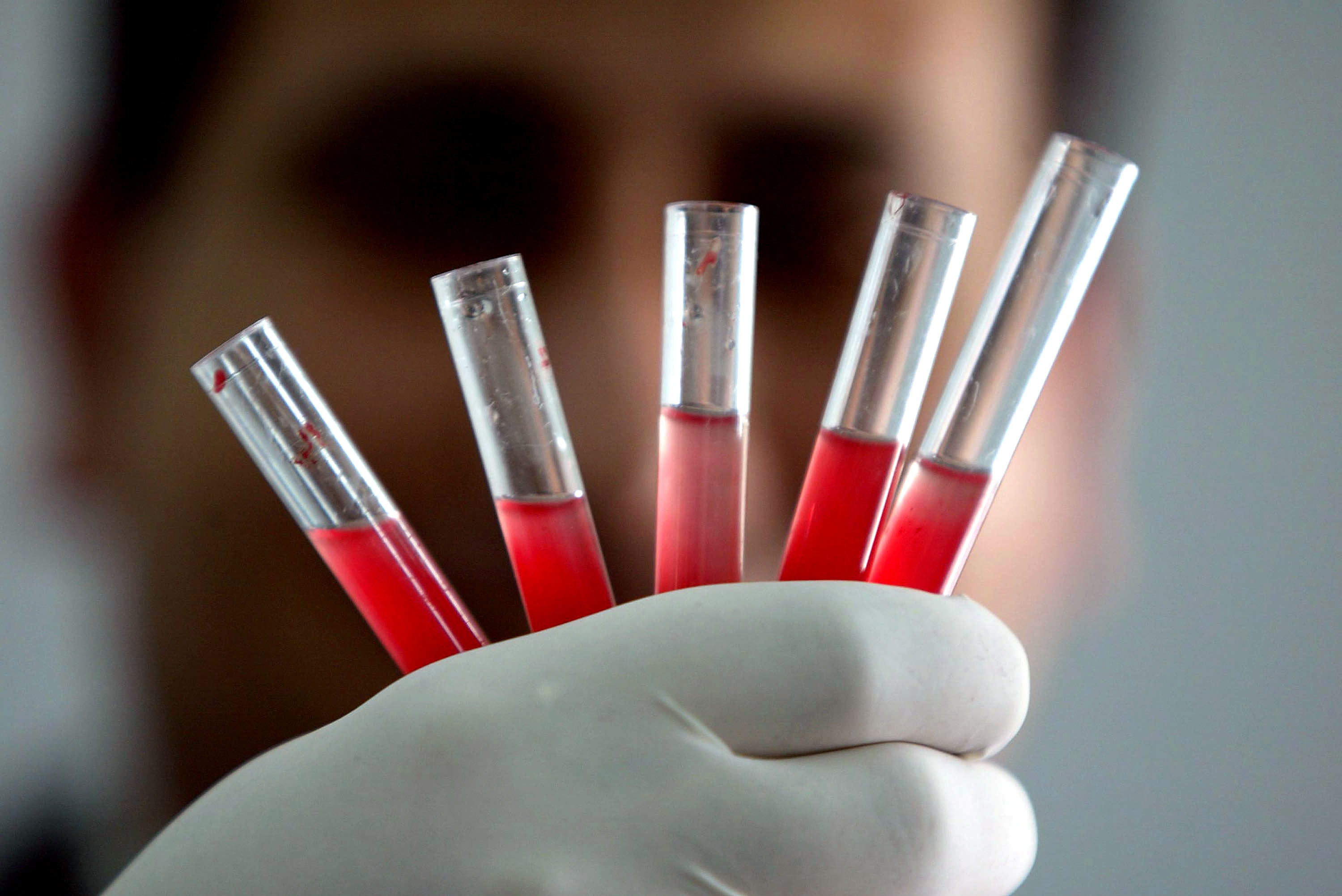 45-facts-about-universal-blood-type