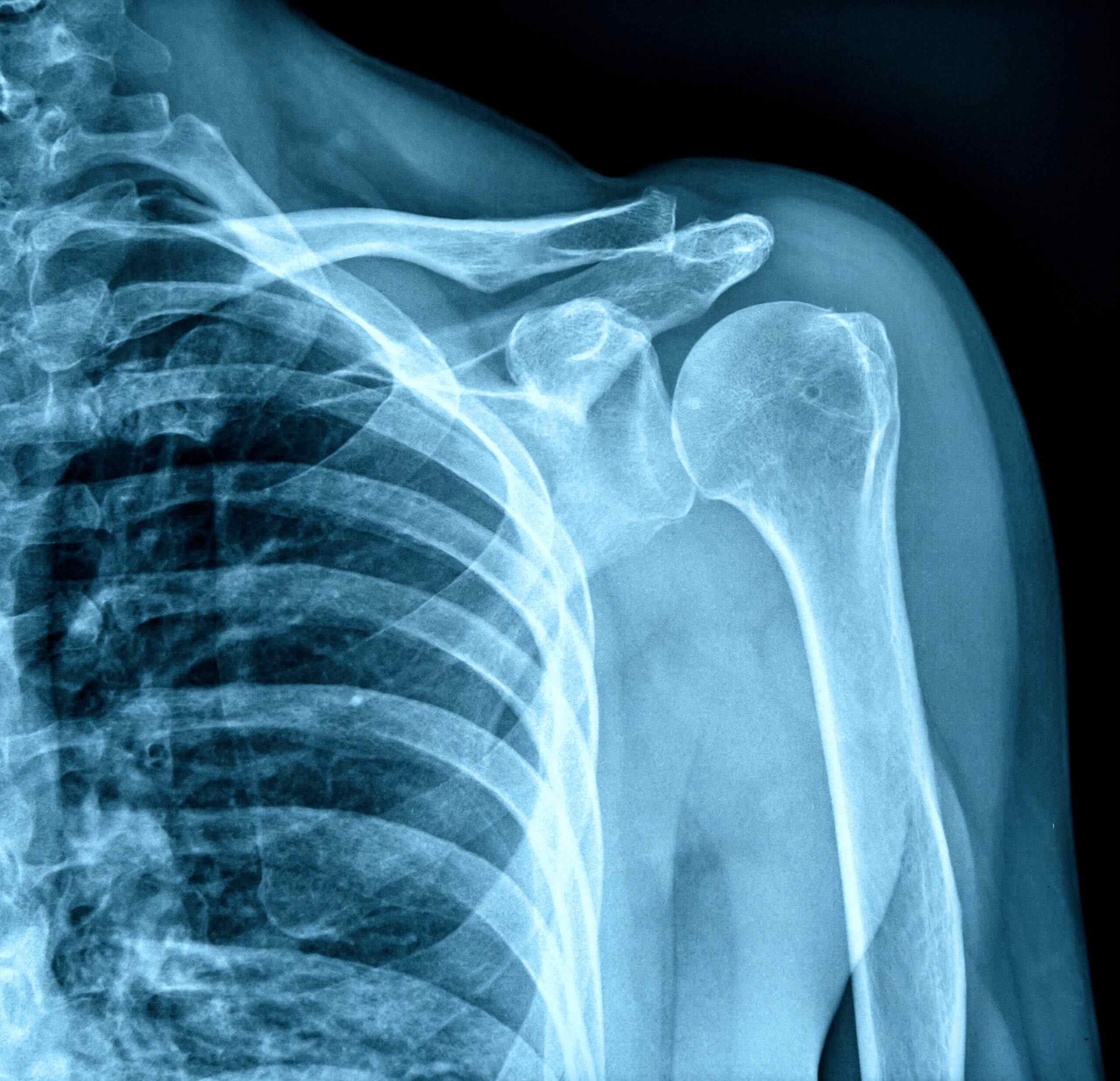 20-facts-about-x-rays